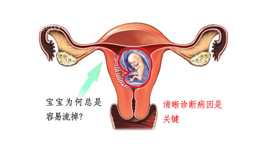 发生胎停育后怎么办